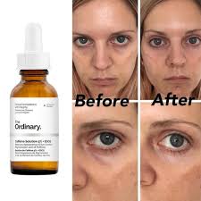 Ceffeine Solution The Ordinary